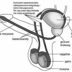 Czy wazektomia to grzech? Odkryj moralne dylematy w Kościele katolickim